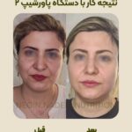 تصویر بعد از درمان