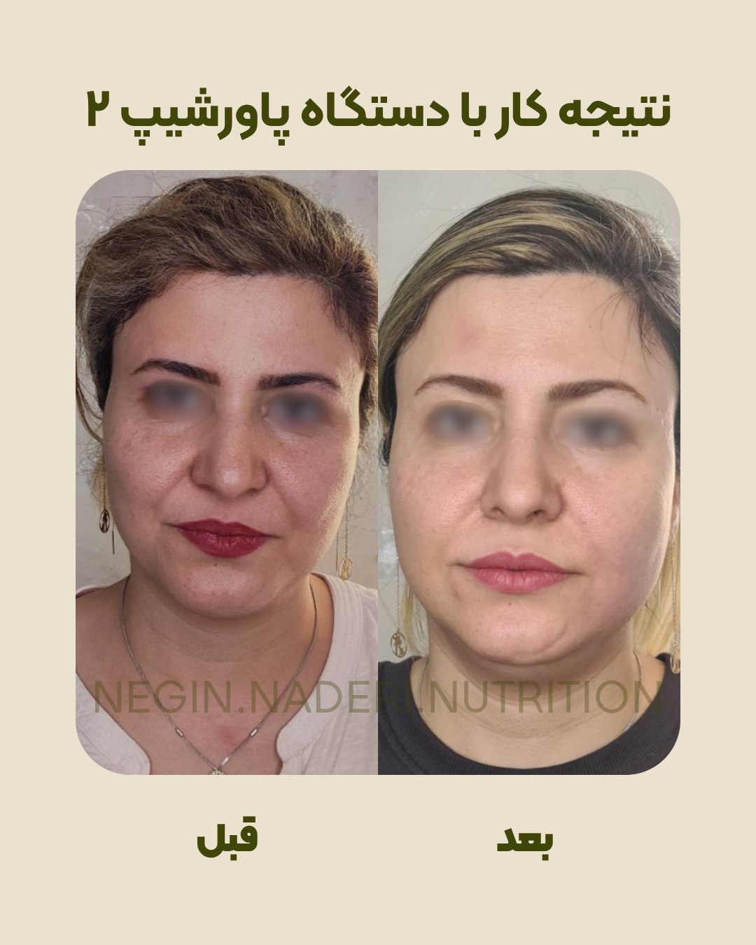تصویر بعد از درمان